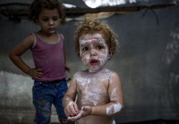 APTOPIX Israel Palestinians Skin Diseases