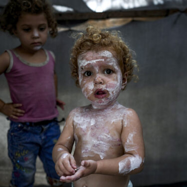 APTOPIX Israel Palestinians Skin Diseases