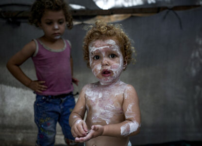 APTOPIX Israel Palestinians Skin Diseases